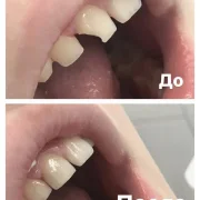 Стоматологическая клиника Главзуб фото 1 на сайте Butovo.su