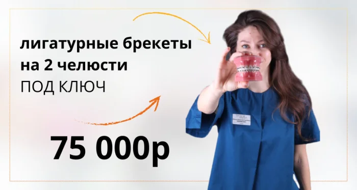 Лигатурные брекеты ПОД КЛЮЧ на 2 челюсти